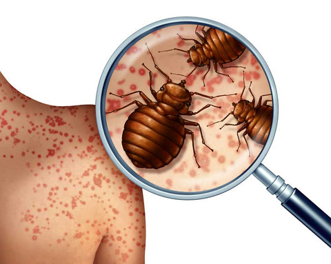 Pictures of bed bug bites - what do bed bug bites look like pictures.  Premo non toxic bed bug spray